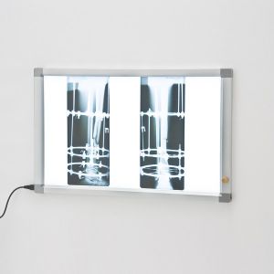 Оборудование для рентгенологии